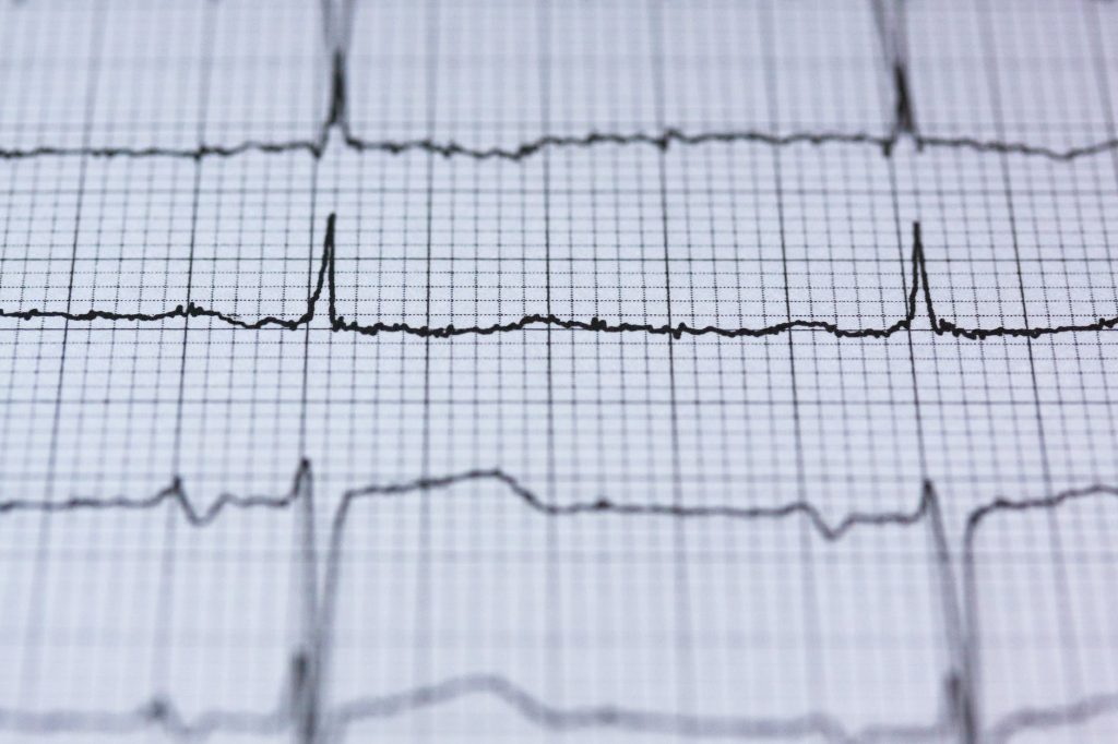 take your team’s pulse